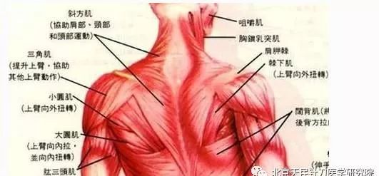 背部疼痛对应部位图片