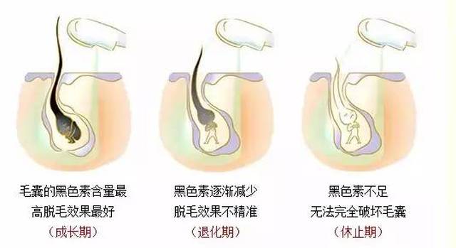 废锌与脱毛用的刮板，差异与创新之路的探索，创新性方案解析_XR34.30.30