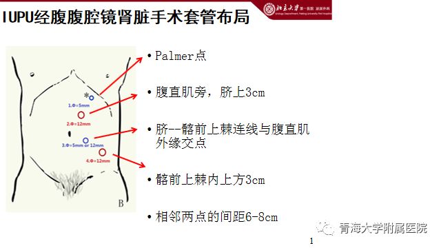 中大泌尿外科医院